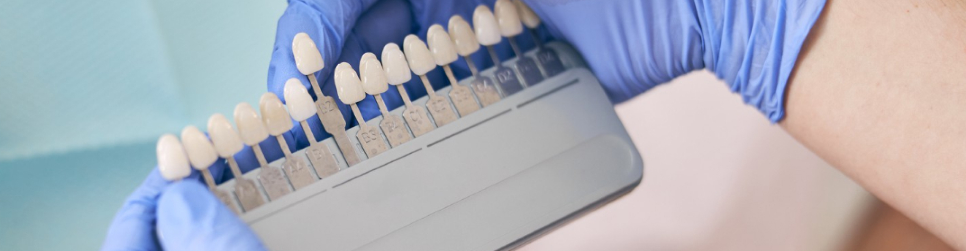 Dentist holding a tooth shade guide to match the color of a patient's teeth before cosmetic treatment.